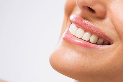 Teeth Whitening